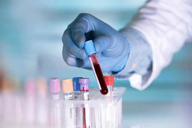 Eliminate the risk of error labelling in hospitals with a mobile printer